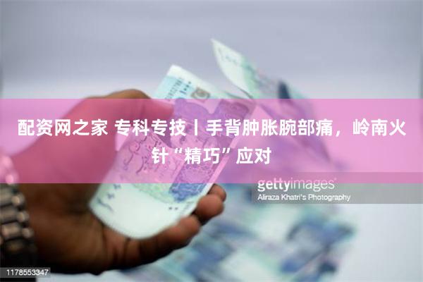 配资网之家 专科专技丨手背肿胀腕部痛，岭南火针“精巧”应对